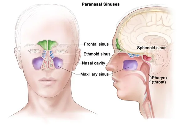 Sinus Surgery